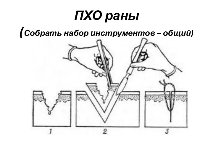 ПХО раны (Собрать набор инструментов – общий)