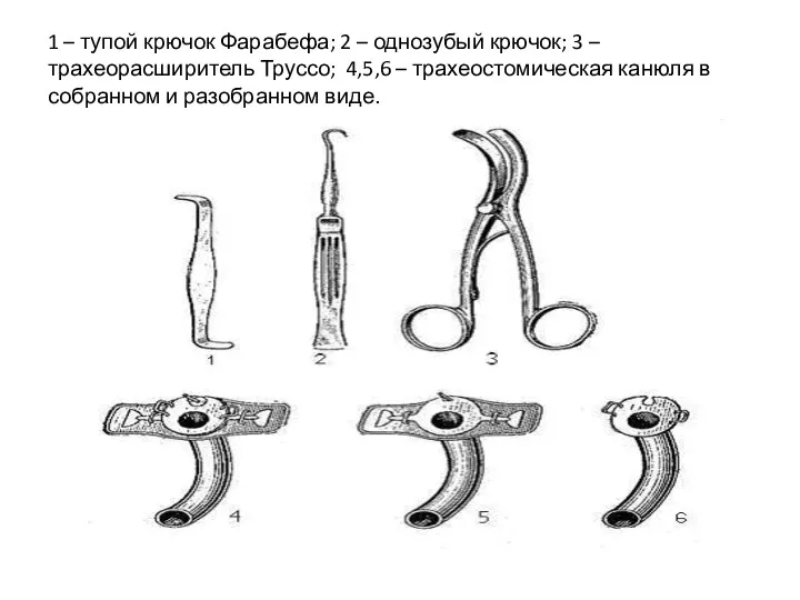 1 – тупой крючок Фарабефа; 2 – однозубый крючок; 3