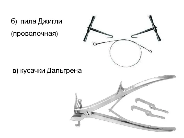 б) пила Джигли (проволочная) в) кусачки Дальгрена