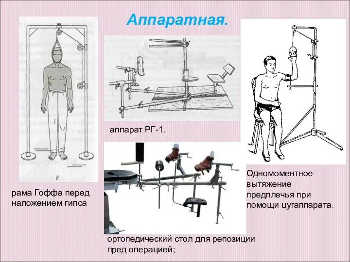 ортопедический стол для репозиции пред операцией; рама Гоффа перед наложением