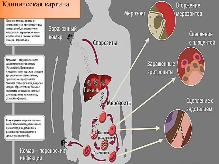 Клиническая картина