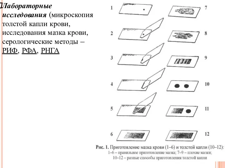 Лабораторные исследования (микроскопия толстой капли крови, исследования мазка крови, серологические методы – РИФ, РФА, РНГА