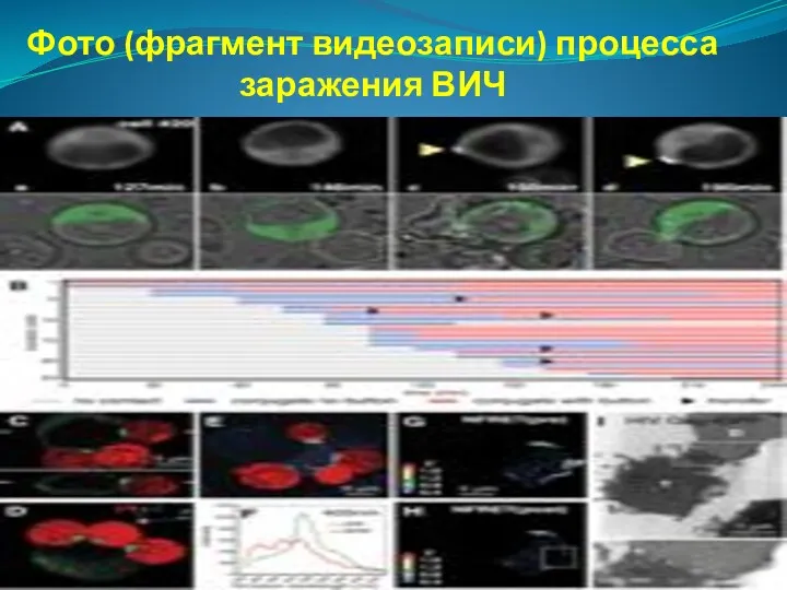 Фото (фрагмент видеозаписи) процесса заражения ВИЧ