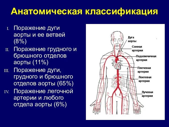 Анатомическая классификация Поражение дуги аорты и ее ветвей (8%) Поражение