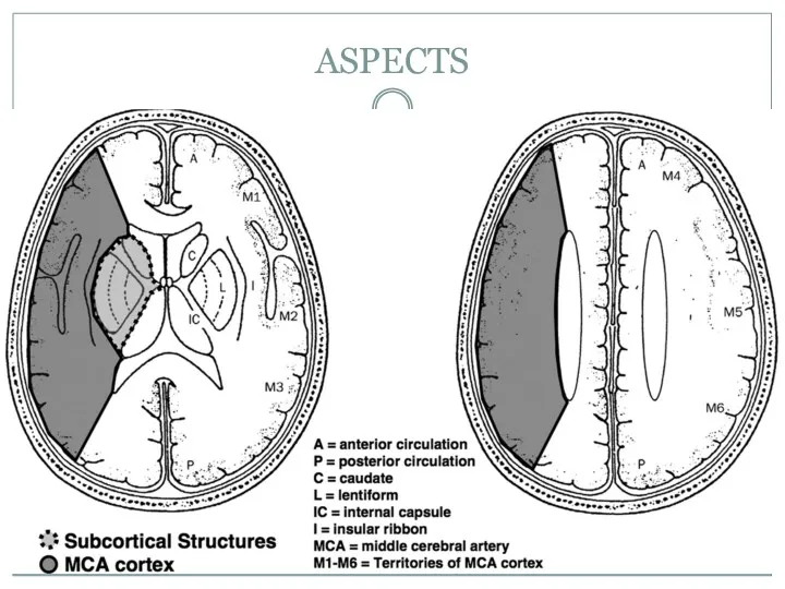 ASPECTS