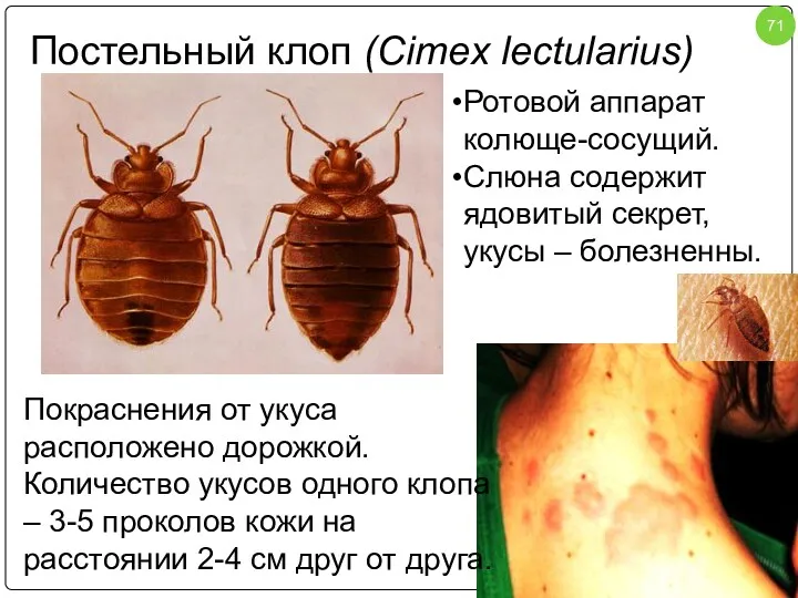 Постельный клоп (Cimex lectularius) Покраснения от укуса расположено дорожкой. Количество