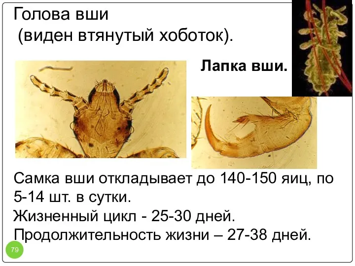 Голова вши (виден втянутый хоботок). Лапка вши. Самка вши откладывает