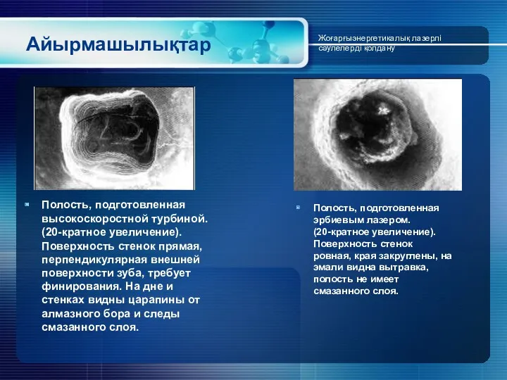 Айырмашылықтар Полость, подготовленная высокоскоростной турбиной. (20-кратное увеличение). Поверхность стенок прямая,