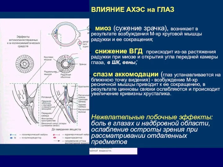 ВЛИЯНИЕ АХЭС на ГЛАЗ миоз (сужение зрачка), возникает в результате