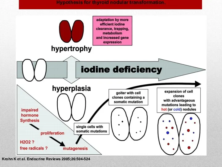 Hypothesis for thyroid nodular transformation. Krohn K et al. Endocrine Reviews 2005;26:504-524