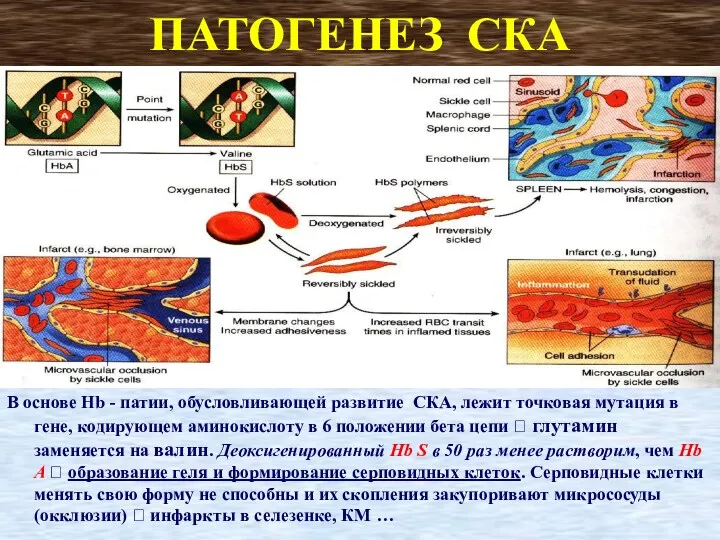 ПАТОГЕНЕЗ СКА В основе Hb - патии, обусловливающей развитие СКА,