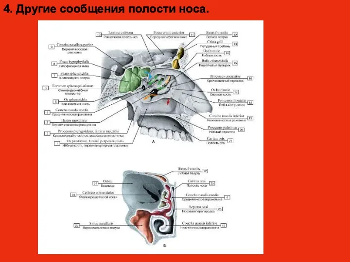 4. Другие сообщения полости носа.