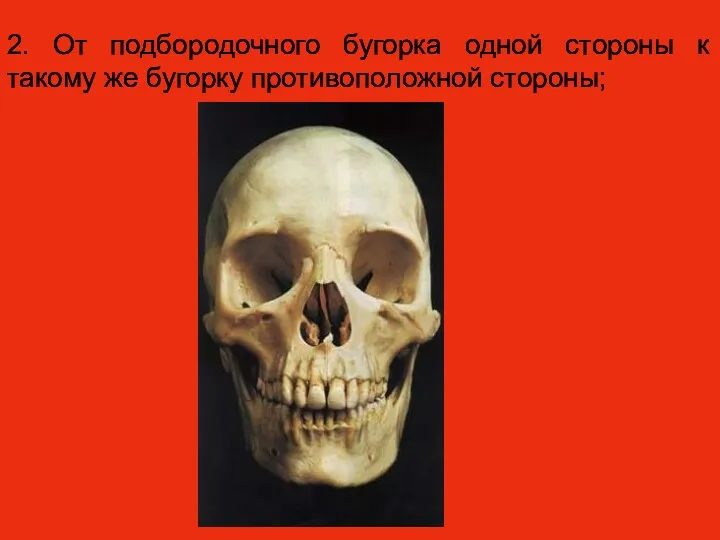 2. От подбородочного бугорка одной стороны к такому же бугорку противоположной стороны;