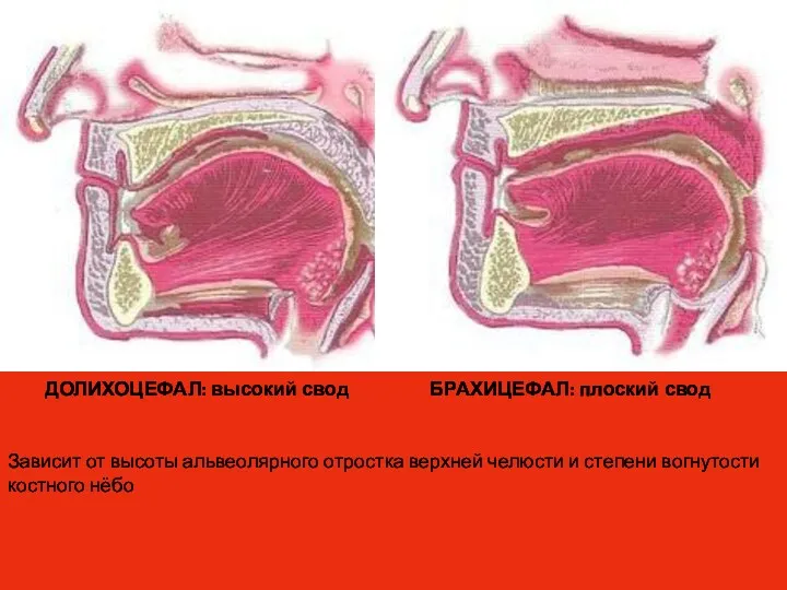 ДОЛИХОЦЕФАЛ: высокий свод БРАХИЦЕФАЛ: плоский свод Зависит от высоты альвеолярного