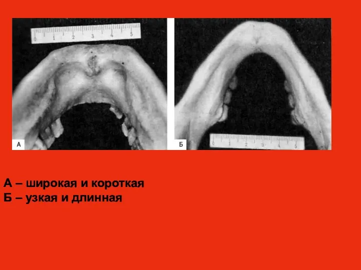 А – широкая и короткая Б – узкая и длинная