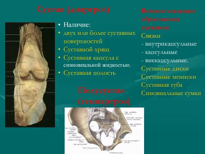 Полусустав (гемиартроз) Сустав (диартроз) Наличие: двух или более суставных поверхностей