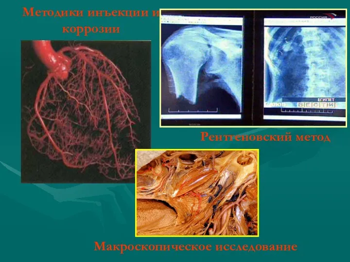Методики инъекции и коррозии Рентгеновский метод Макроскопическое исследование