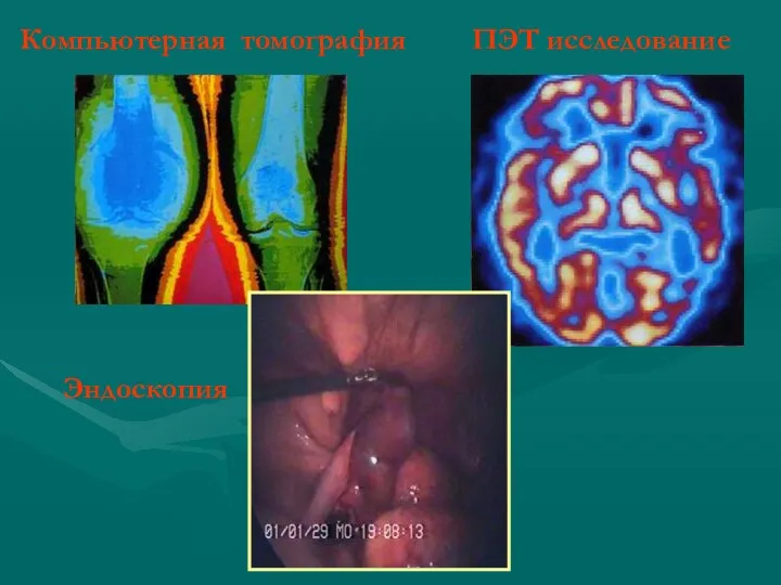 Компьютерная томография ПЭТ исследование Эндоскопия