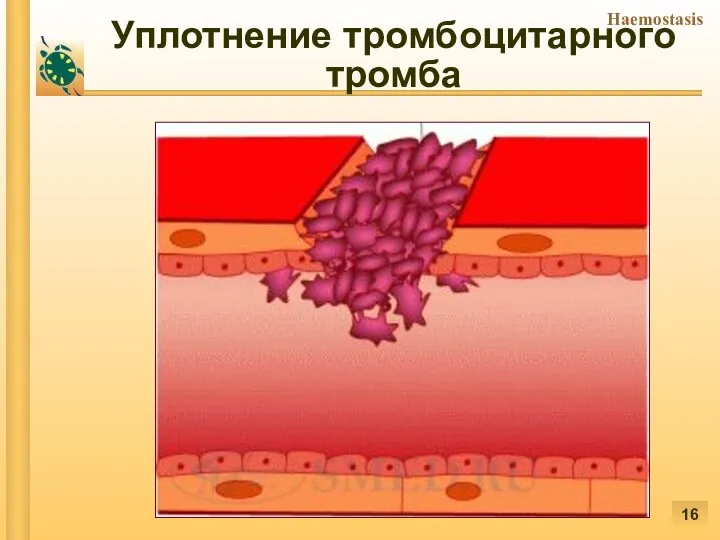 Уплотнение тромбоцитарного тромба