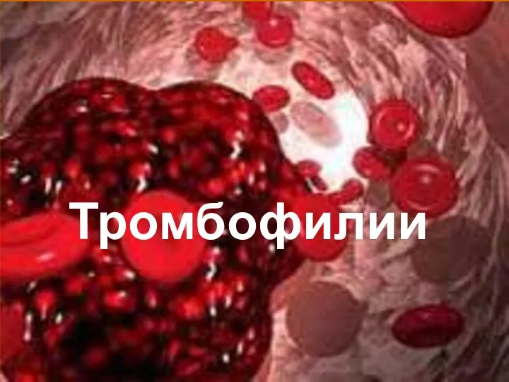 Тромбофилии