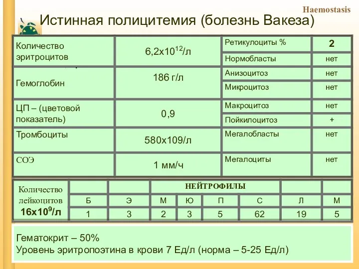 Истинная полицитемия (болезнь Вакеза) Гематокрит – 50% Уровень эритропоэтина в