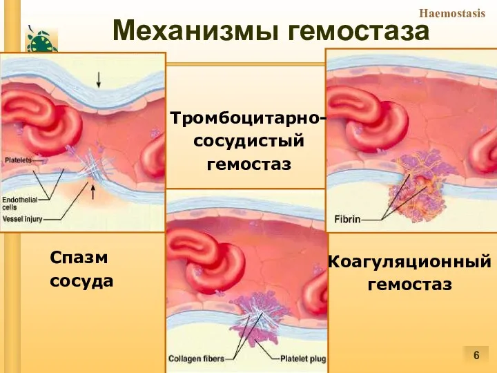 Механизмы гемостаза Спазм сосуда Тромбоцитарно- сосудистый гемостаз Коагуляционный гемостаз