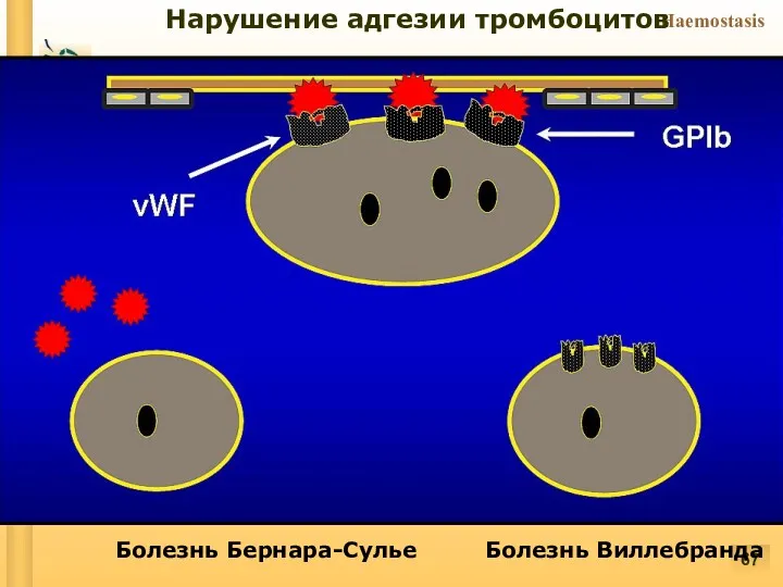 Нарушение адгезии тромбоцитов Болезнь Бернара-Сулье Болезнь Виллебранда