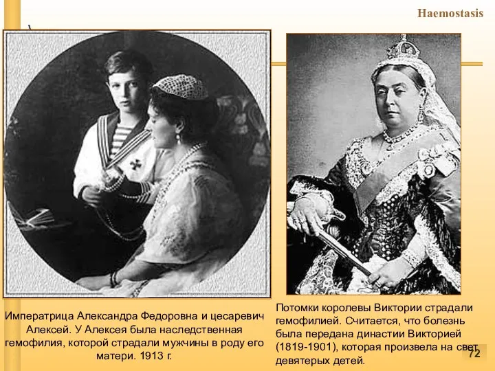 Потомки королевы Виктории страдали гемофилией. Считается, что болезнь была передана