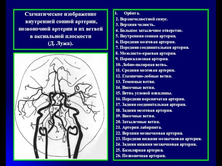Схематическое изображение внутренней cонной артерии, позвоночной артерии и их ветвей