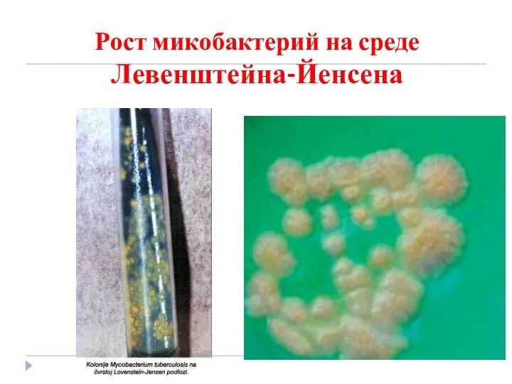Рост микобактерий на среде Левенштейна-Йенсена