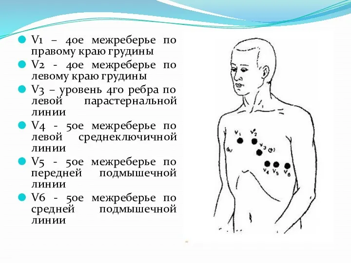 V1 – 4ое межреберье по правому краю грудины V2 -