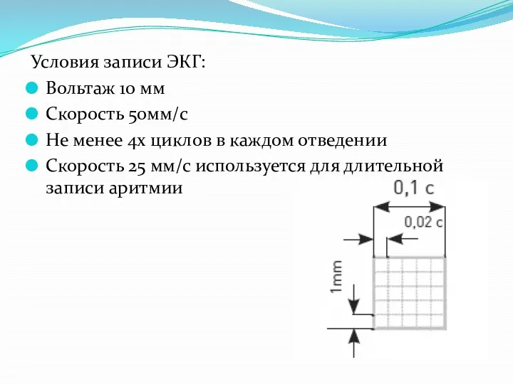 Условия записи ЭКГ: Вольтаж 10 мм Скорость 50мм/с Не менее