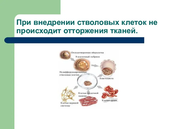 При внедрении стволовых клеток не происходит отторжения тканей.