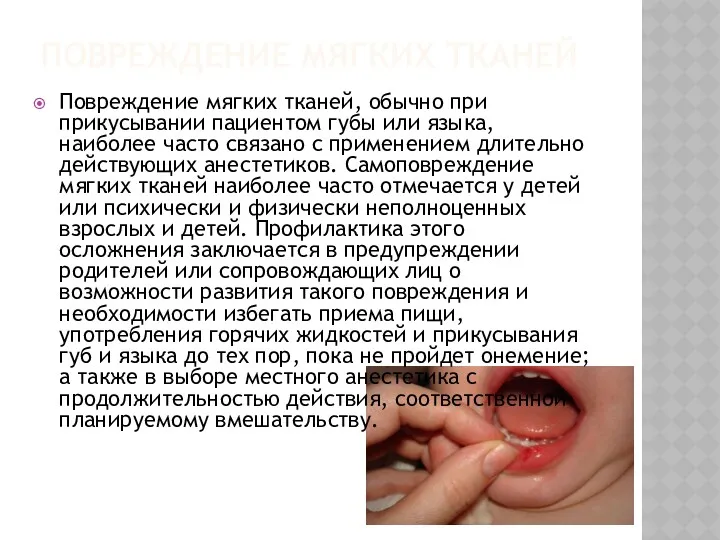 ПОВРЕЖДЕНИЕ МЯГКИХ ТКАНЕЙ Повреждение мягких тканей, обычно при прикусывании пациентом губы или языка,