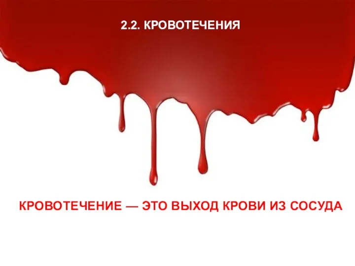 2.2. КРОВОТЕЧЕНИЯ 2.2. КРОВОТЕЧЕНИЯ КРОВОТЕЧЕНИЕ — ЭТО ВЫХОД КРОВИ ИЗ СОСУДА