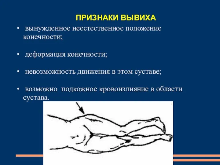 вынужденное неестественное положение конечности; деформация конечности; невозможность движения в этом