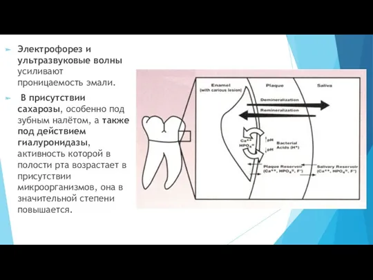 Электрофорез и ультразвуковые волны усиливают проницаемость эмали. В присутствии сахарозы,