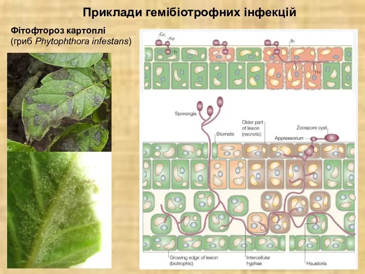 Приклади гемібіотрофних інфекцій Фітофтороз картоплі (гриб Phytophthora infestans)