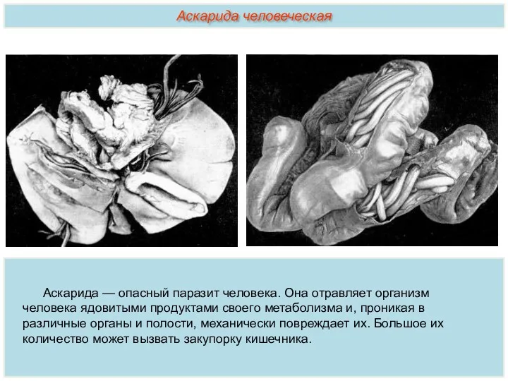 Аскарида — опасный паразит человека. Она отравляет организм человека ядовитыми