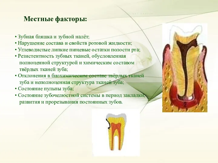 Местные факторы: Зубная бляшка и зубной налёт; Нарушение состава и