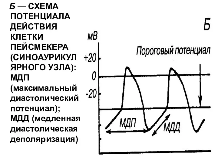 Б — СХЕМА ПОТЕНЦИАЛА ДЕЙСТВИЯ КЛЕТКИ ПЕЙСМЕКЕРА (СИНОАУРИКУЛЯРНОГО УЗЛА): МДП