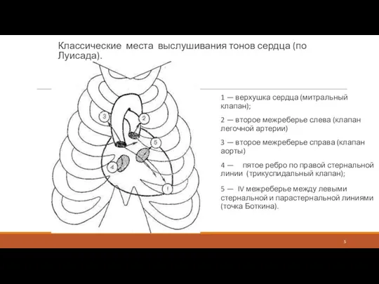 Классические места выслушивания тонов сердца (по Луисада). 1 — верхушка