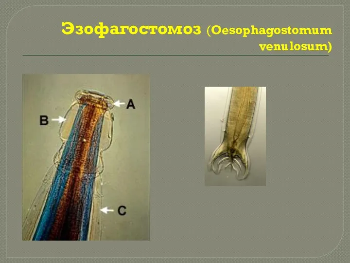Эзофагостомоз (Oesophagostomum venulosum)