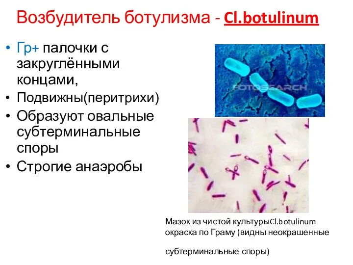 Мазок из чистой культурыCl.botulinum окраска по Граму (видны неокрашенные субтерминальные