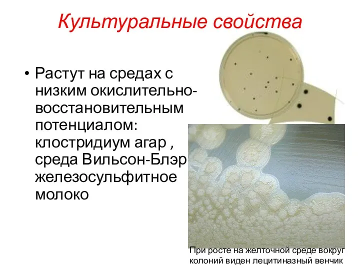 Растут на средах с низким окислительно-восстановительным потенциалом: клостридиум агар ,