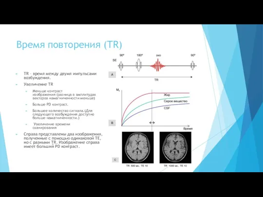 Время повторения (TR) TR – время между двумя импульсами возбуждения.