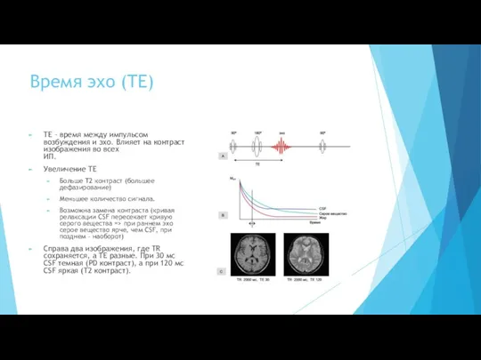 Время эхо (TE) TE – время между импульсом возбуждения и