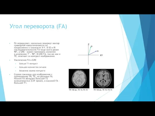 Угол переворота (FA) FA определяет, насколько повернут вектор суммарной намагниченности