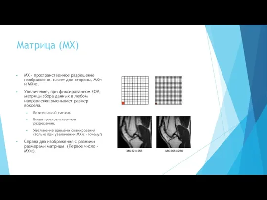 Матрица (MX) MX - пространственное разрешение изображения, имеет две стороны,