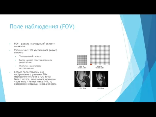 Поле наблюдения (FOV) FOV - размер исследуемой области пациента. Увеличение